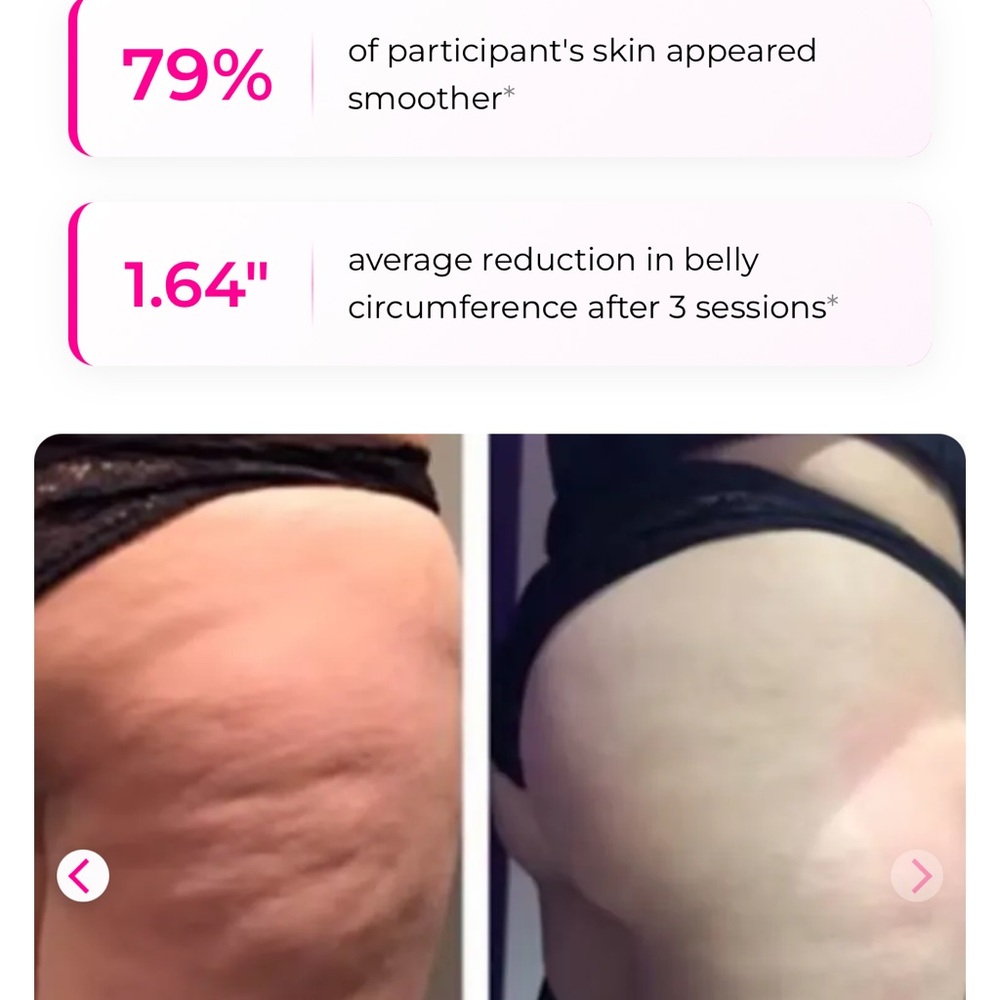 3in1 Body Sculpting Machine,Professional Radio Frequency Skin Tightening Device - Picture 11 of 12